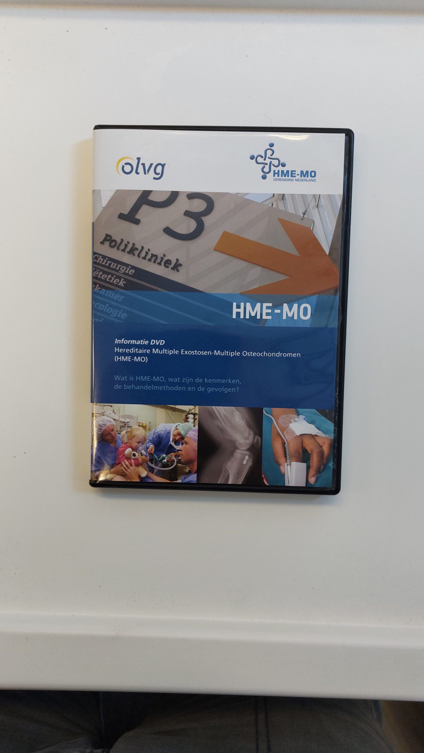 Informatie DVD – Hereditaire Multiple Exostosen-Multiple Osteochondromen(HME-MO)