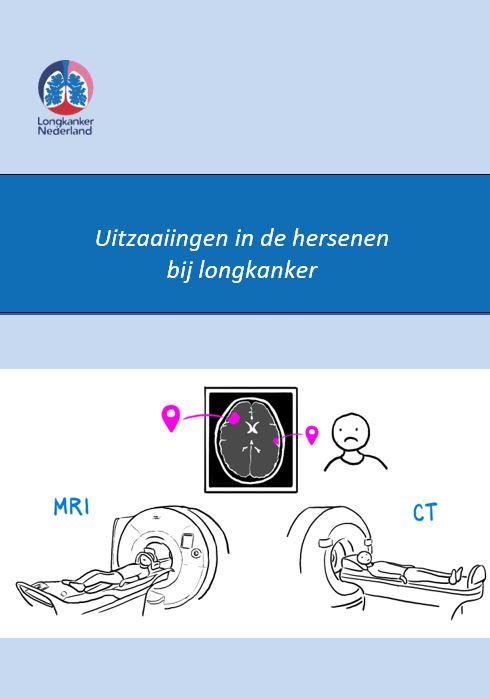 Uitzaaiingen bij Longkanker