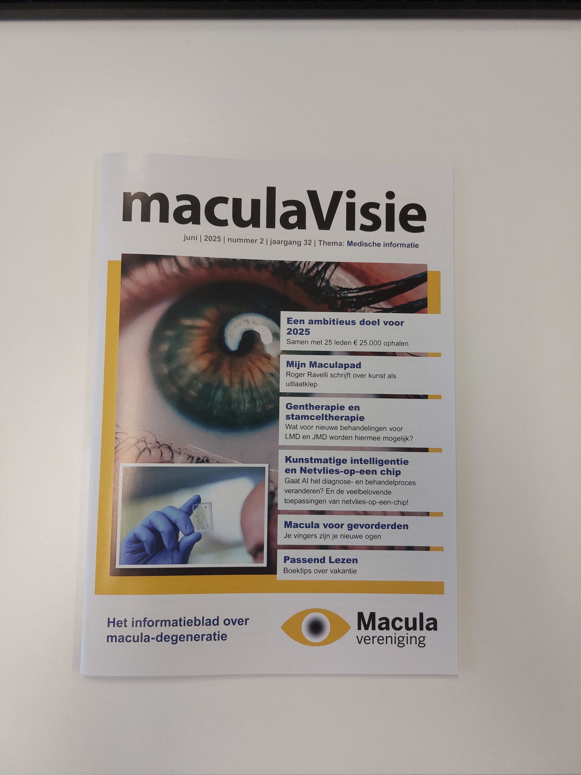 2025 – Nr. 2 MaculaVisie