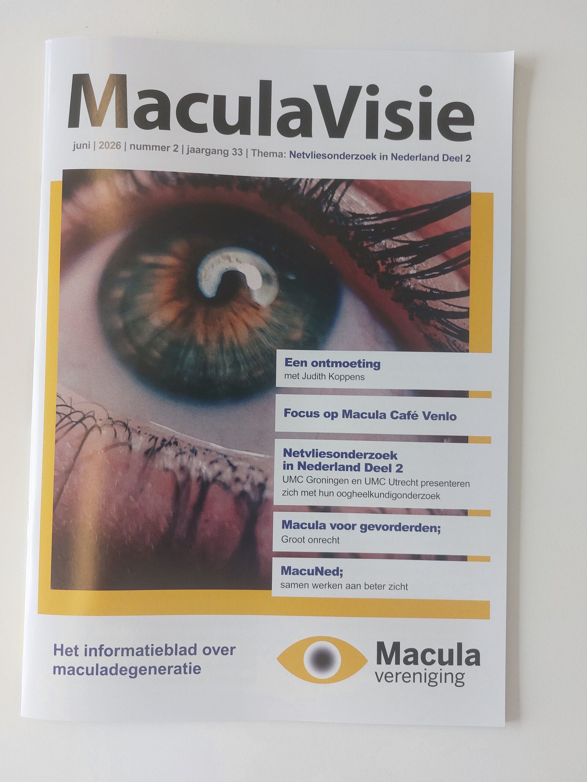2026 – Nr. 2 MaculaVisie